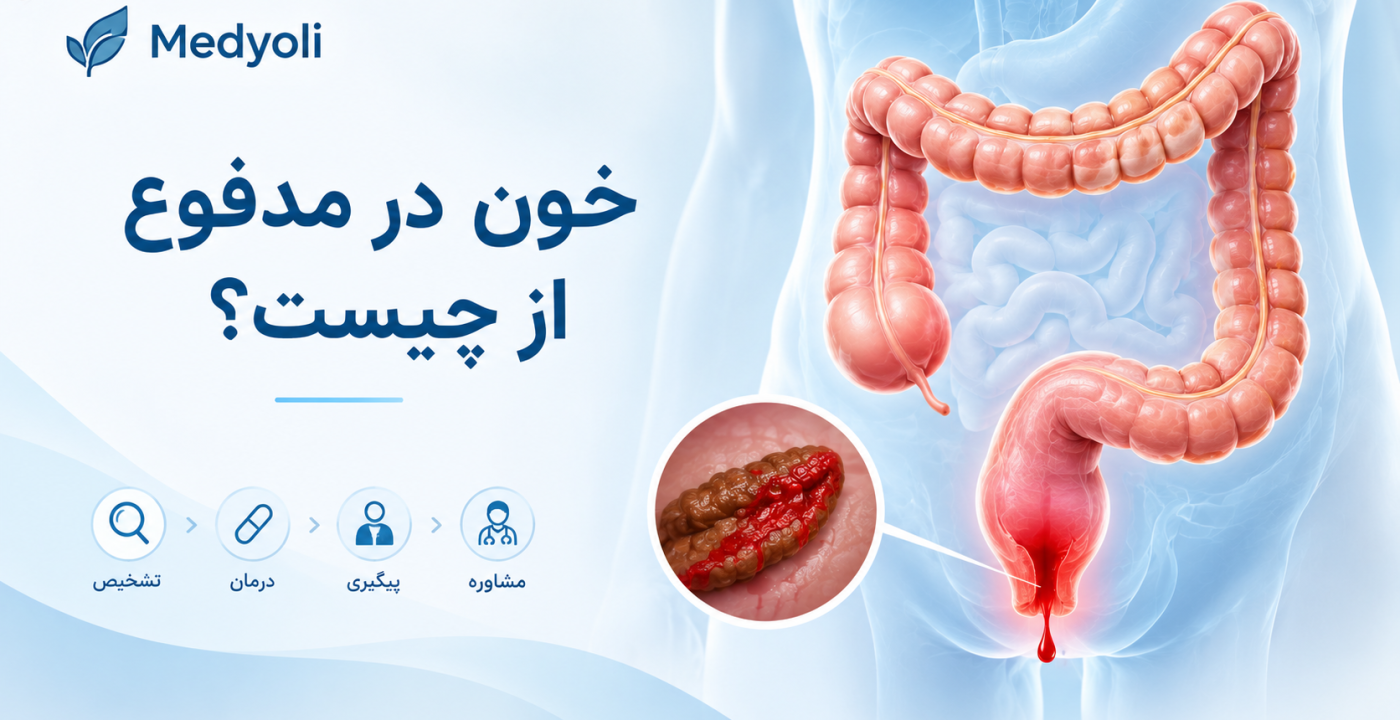 خون در مدفوع از چيست؟ علل،رنگ خون و زمان مراجعه به پزشك