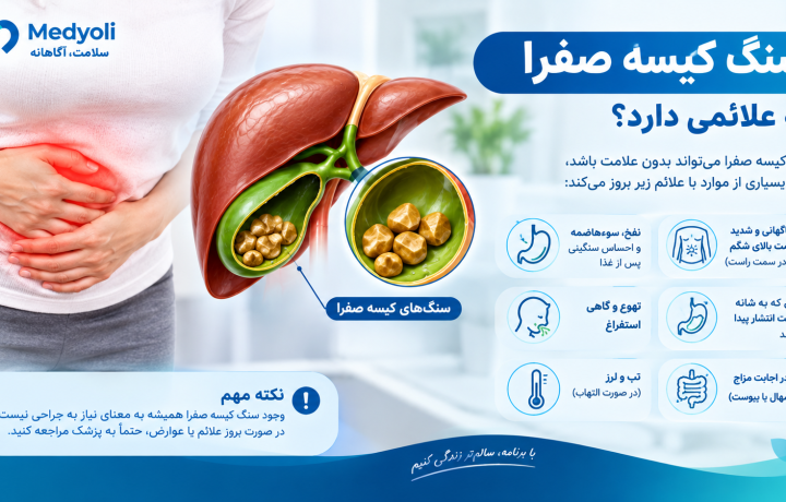 سنگ کیسه صفرا چه علائمی دارد؟ علائم سنگ صفرا، درد کیسه صفرا و زمان مراجعه به پزشک