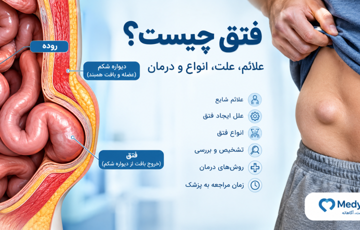 فتق چیست؟ علائم، علت، انواع و زمان مراجعه به پزشک