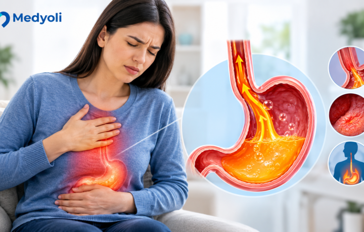 رفلاکس معده چیست؟ علائم، علت و زمان مراجعه به پزشک