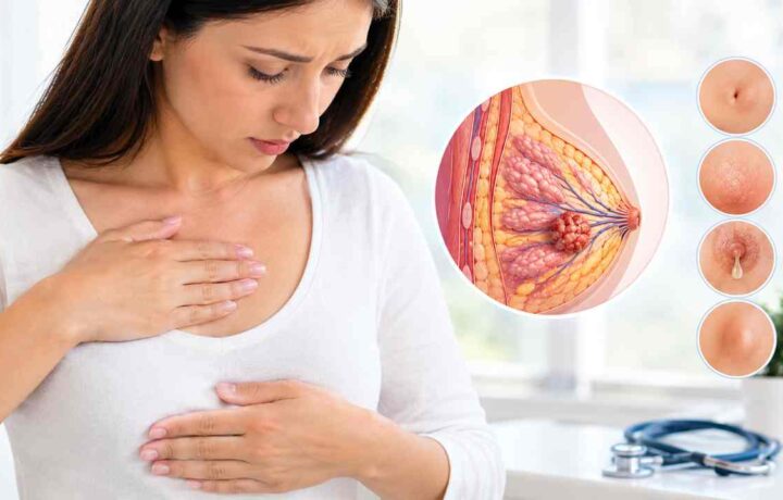 علائم هشدار سرطان پستان چیست؟ نشانه‌هایی که نباید نادیده بگیرید